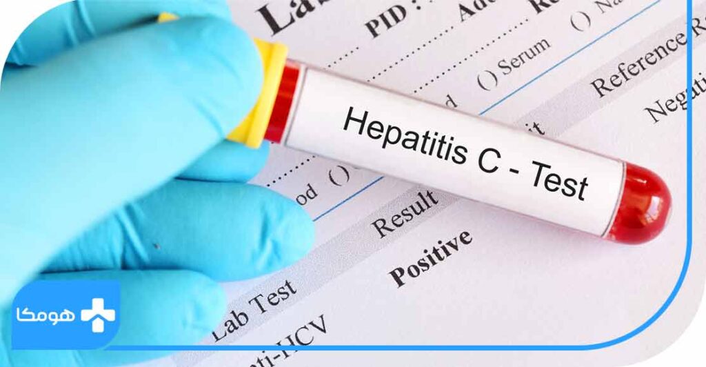 آزمایش HCV چیست؟